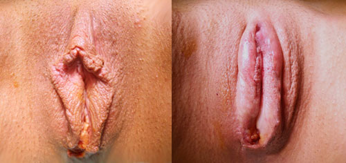 Большие розовые половые губы фото