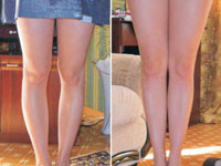 Как скрыть кривые, полные или худые ноги с помощью одежды