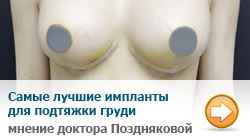 «Почему в 13 лет обвислая грудь? Есть ли способ это как то исправить?» — Яндекс Кью